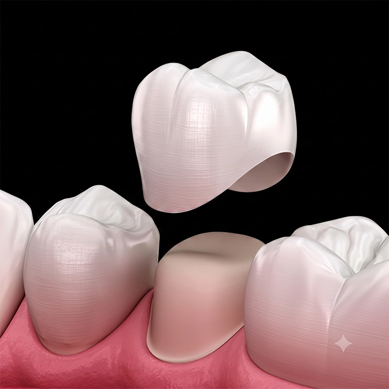 korony zębowe DSA Dental Clinic